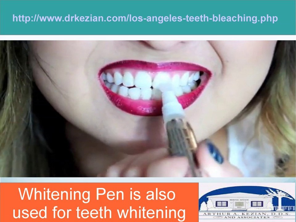 Teeth Whitening Methods