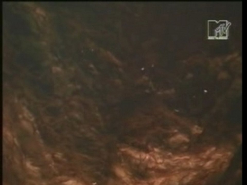 Massive Attack - Teardrop