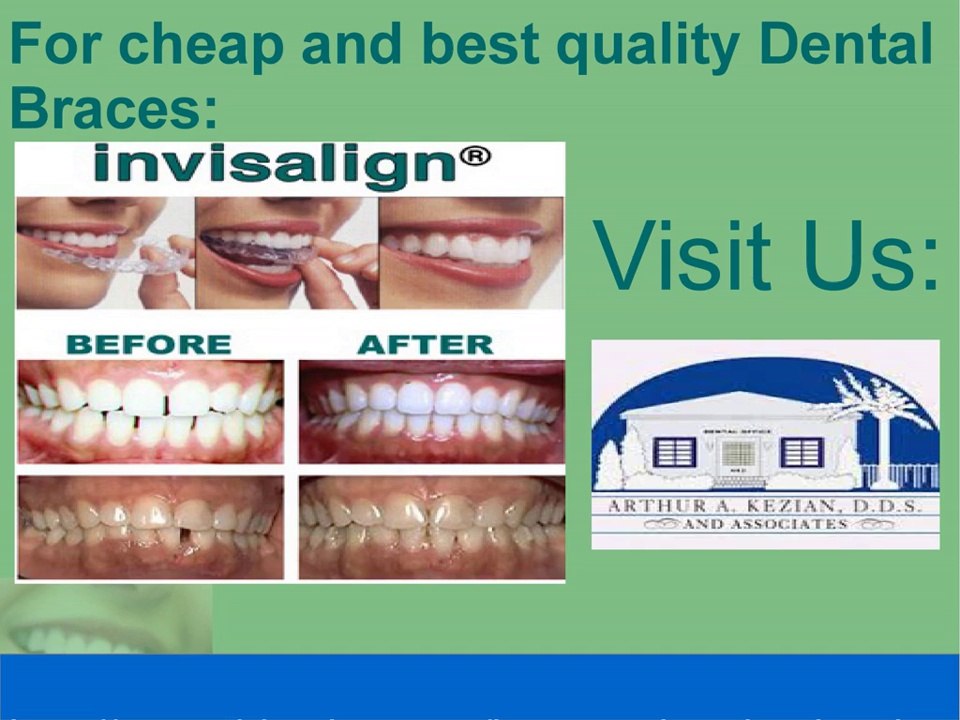 Cosmetic Dentistry And Types Of Treatments