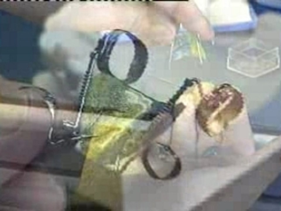 Distal Jet and Uprighter Jet