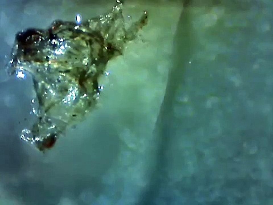 Understanding the Silent Superbug