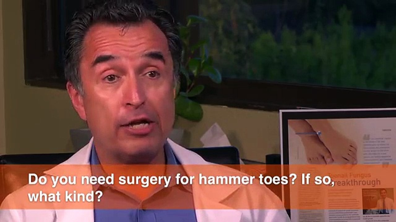 Do I need surgery for hammer toes, If so, what?
