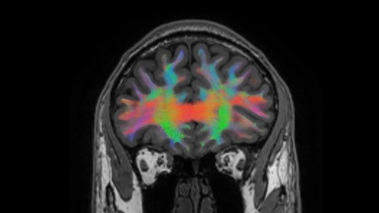 Illuminating neural networks