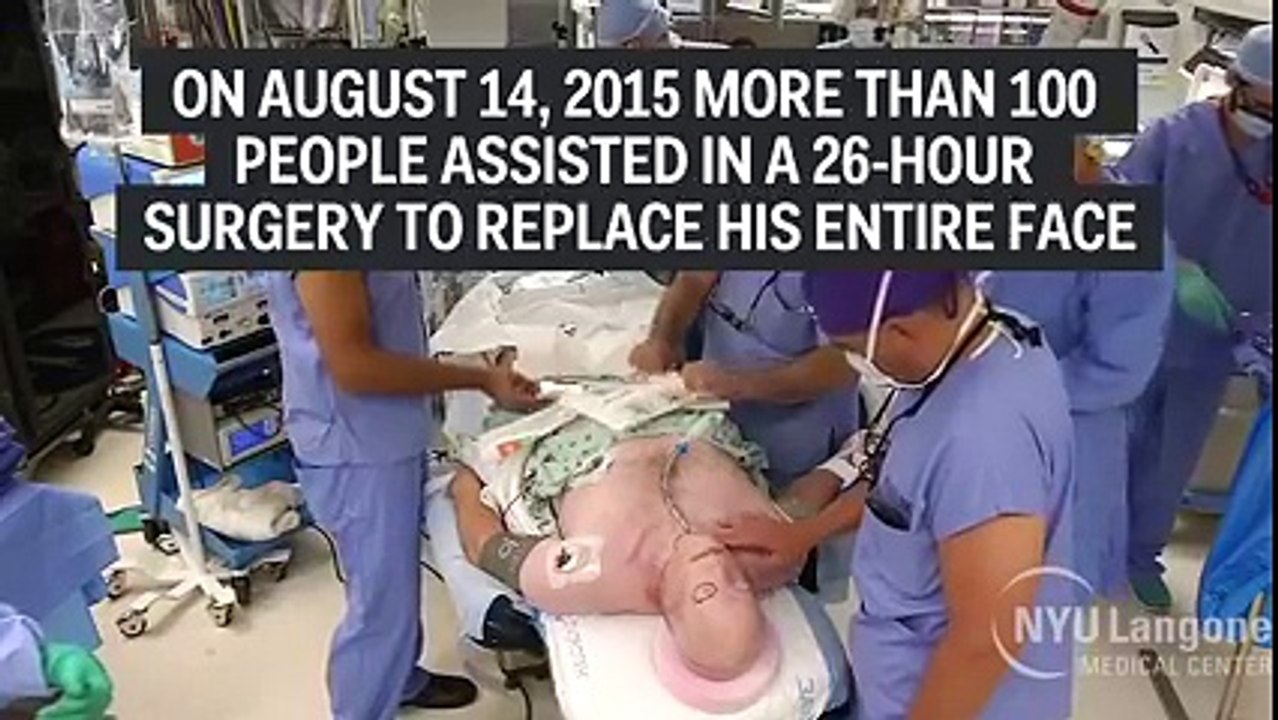 Sergons completed Most Complex Facial Transplant