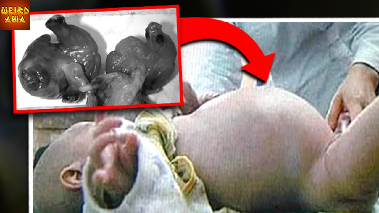 Baby Born PREGNANT With Twins | SHOCKING | Weird Asia