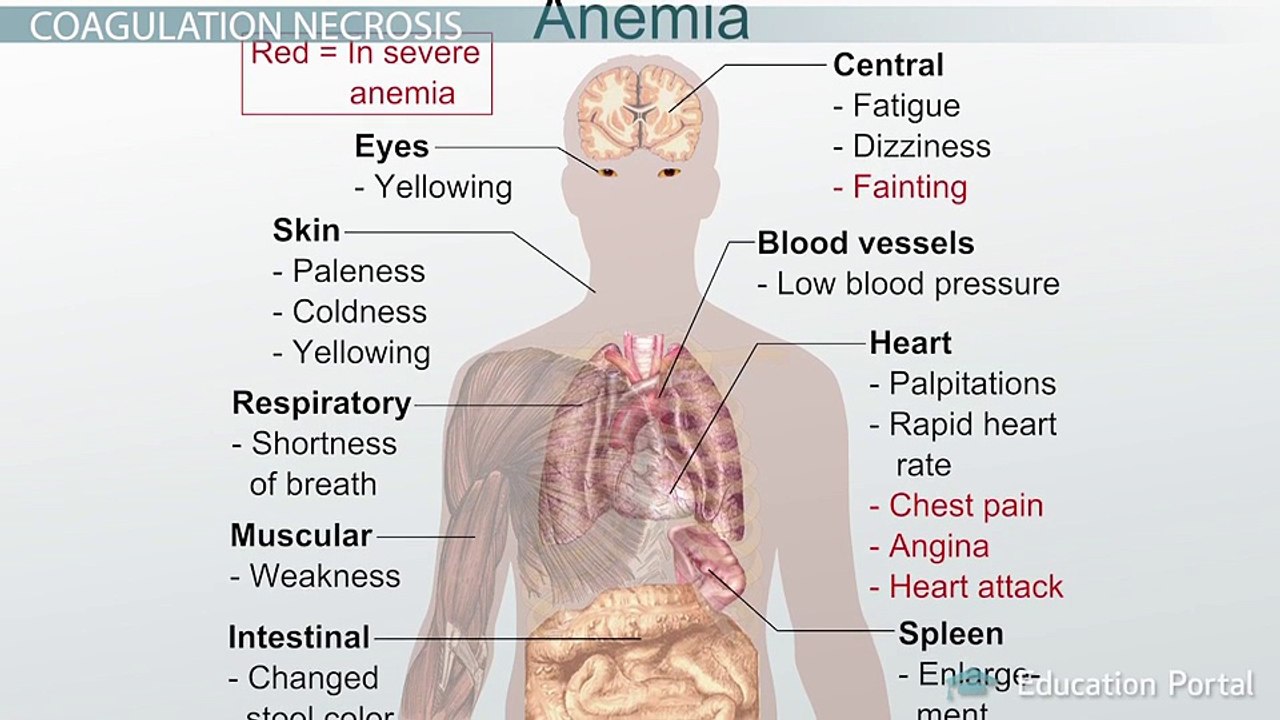Irreversible Cellular Injury and Death: Types and Causes