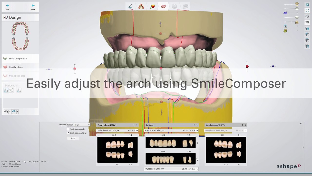 Full Dentures Workflow