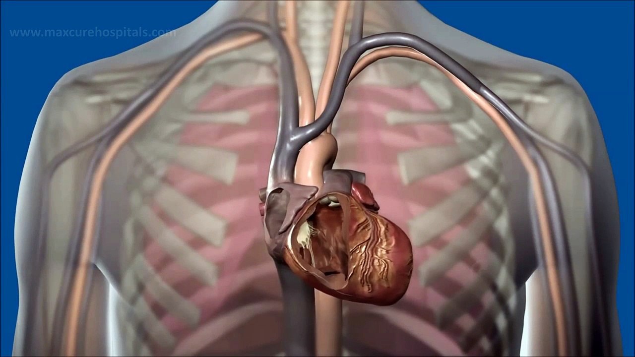 What is Pacemaker and how does it work - Pacemaker Implantation in Hyderabad India