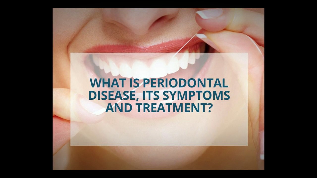 What is Periodontal Disease, its symptoms and treatment?