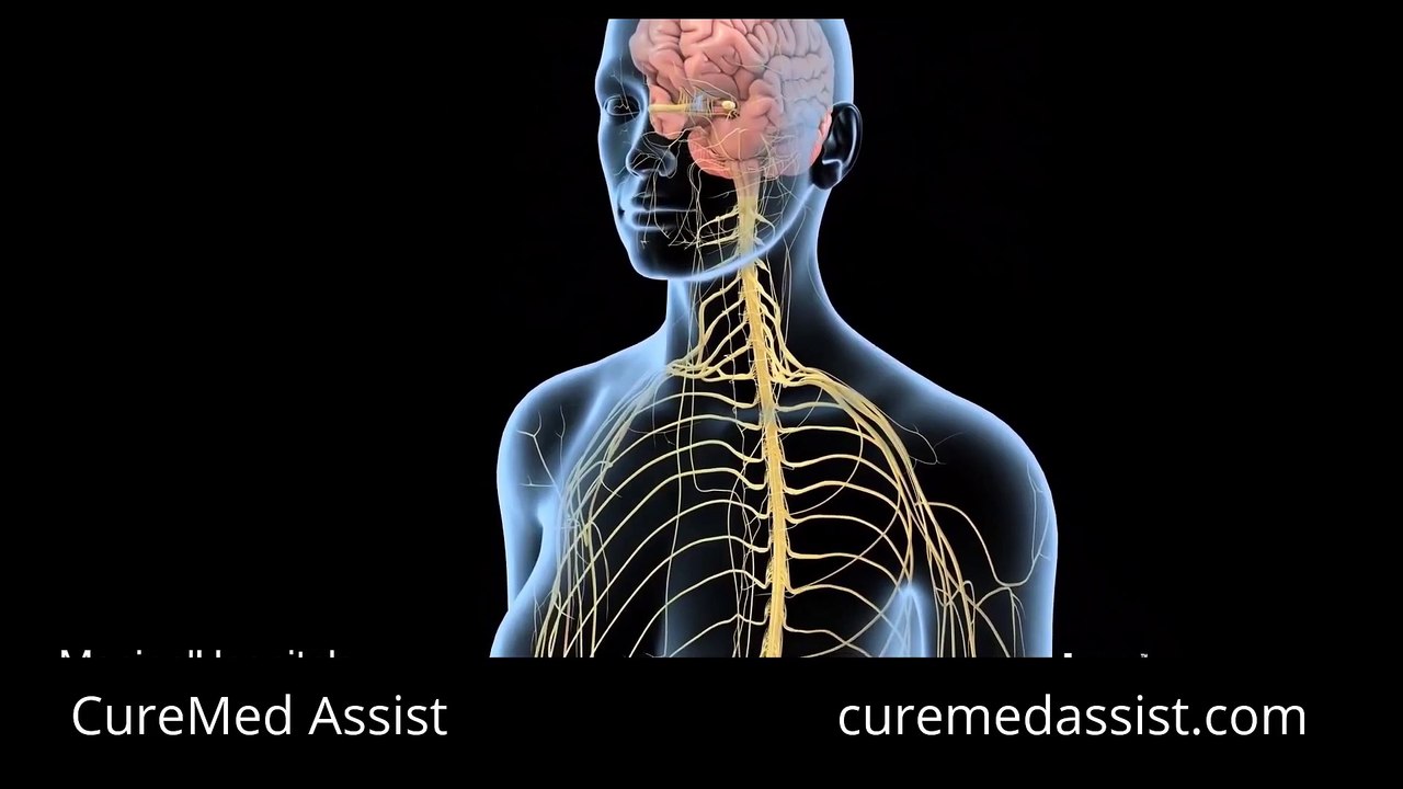 Types Of Neuropathy & Its Treatment – CureMed Assist – Medical Tourism Company