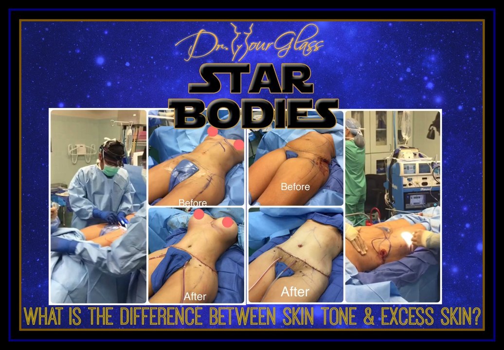 What is the difference between skin tone and excess skin