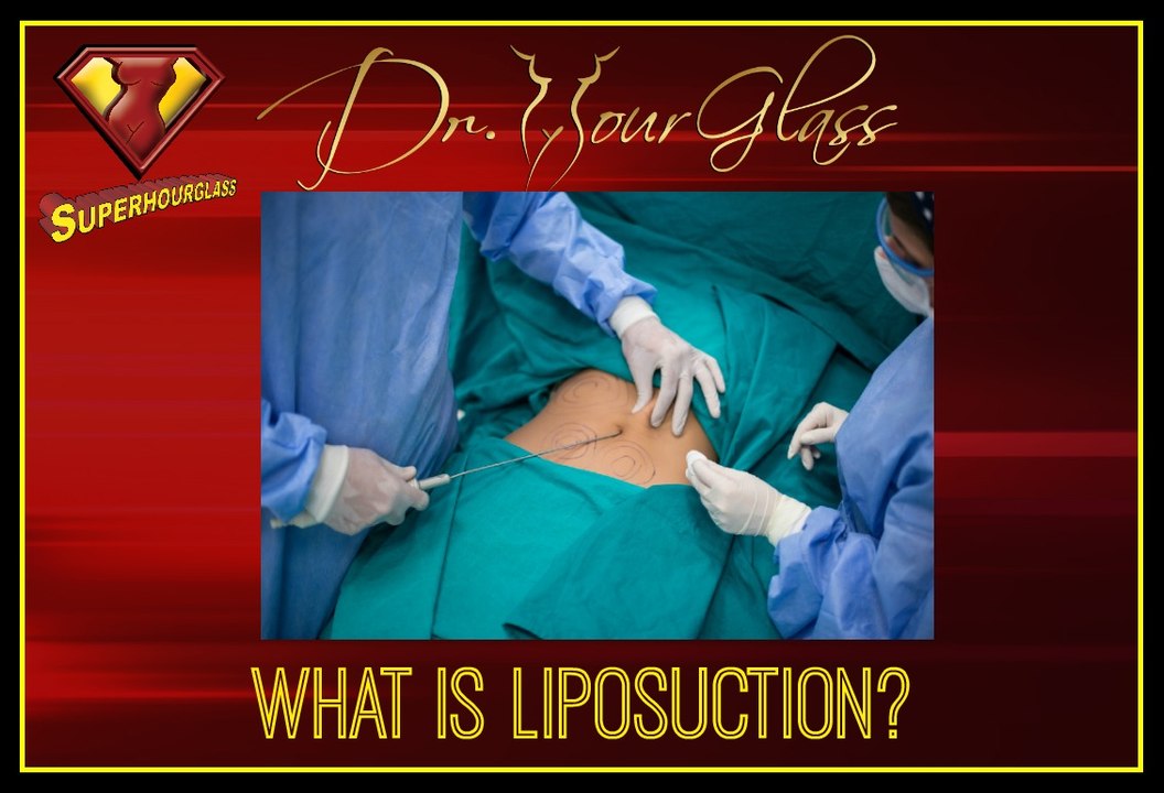 What is liposuction