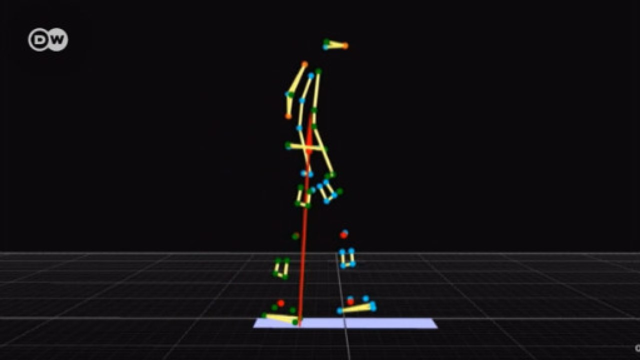 Tecnologia de cinema ajuda na adaptação ao uso de próteses