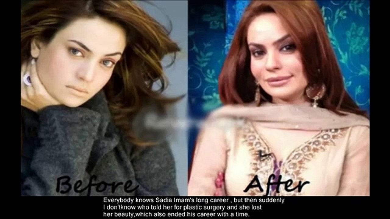 Disadvantages of plastic surgery