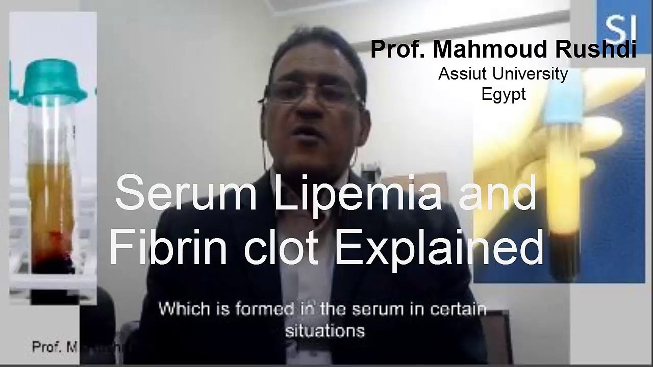Serum Lipemia and Fibrin Clot Explained