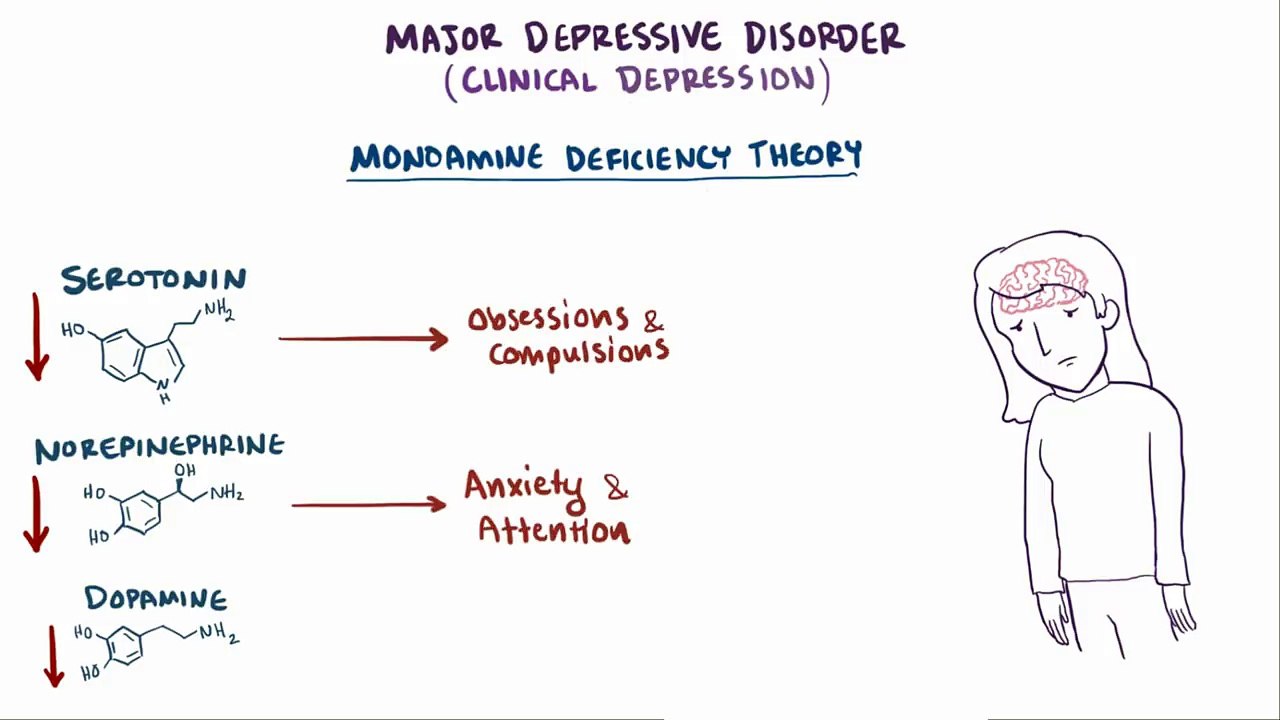Clinical depression - major, post-partum, atypical, melancholic, persistent