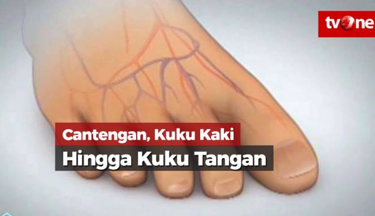 Cantengan, Dari Kuku Kaki hingga Kuku Tangan