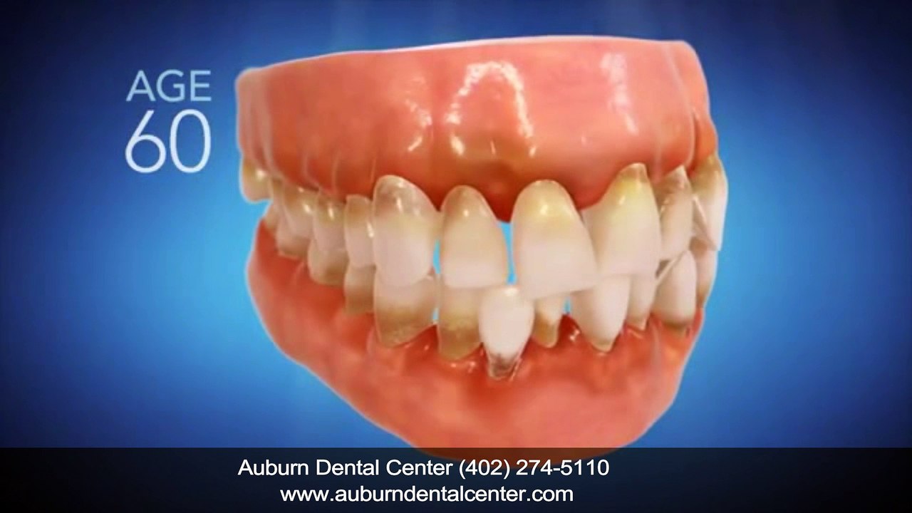 Invisalign Dentist Auburn NE