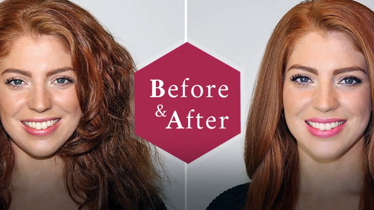 Different Types of Acne and Treatments