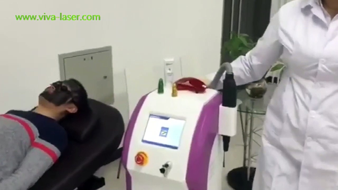 Laser carbon facial machine introduction
