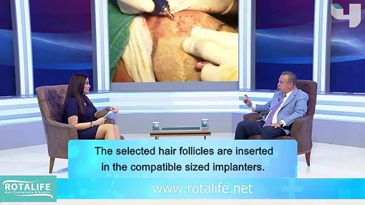 What is DHI hair transplantation, what are its features