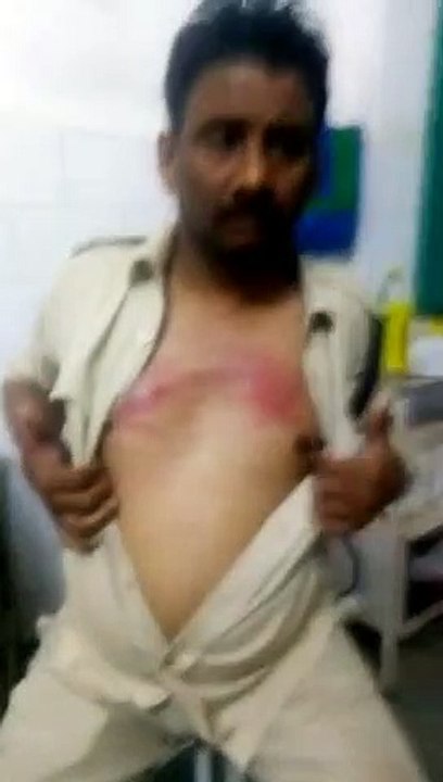 MP police constables are fighting for distribution on illegal money