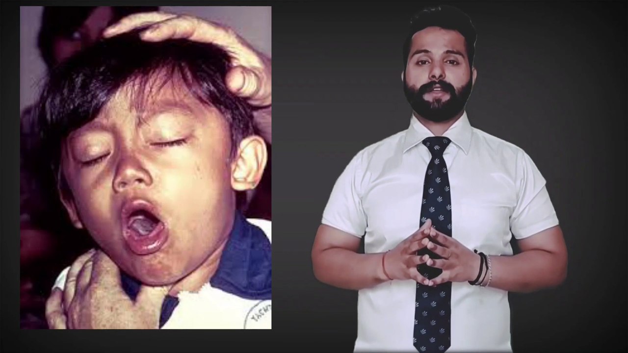 Secret Symptoms of Corona-virus in Body day by day | कोरोना वायरस का ये राज !! Covid-19 Updates