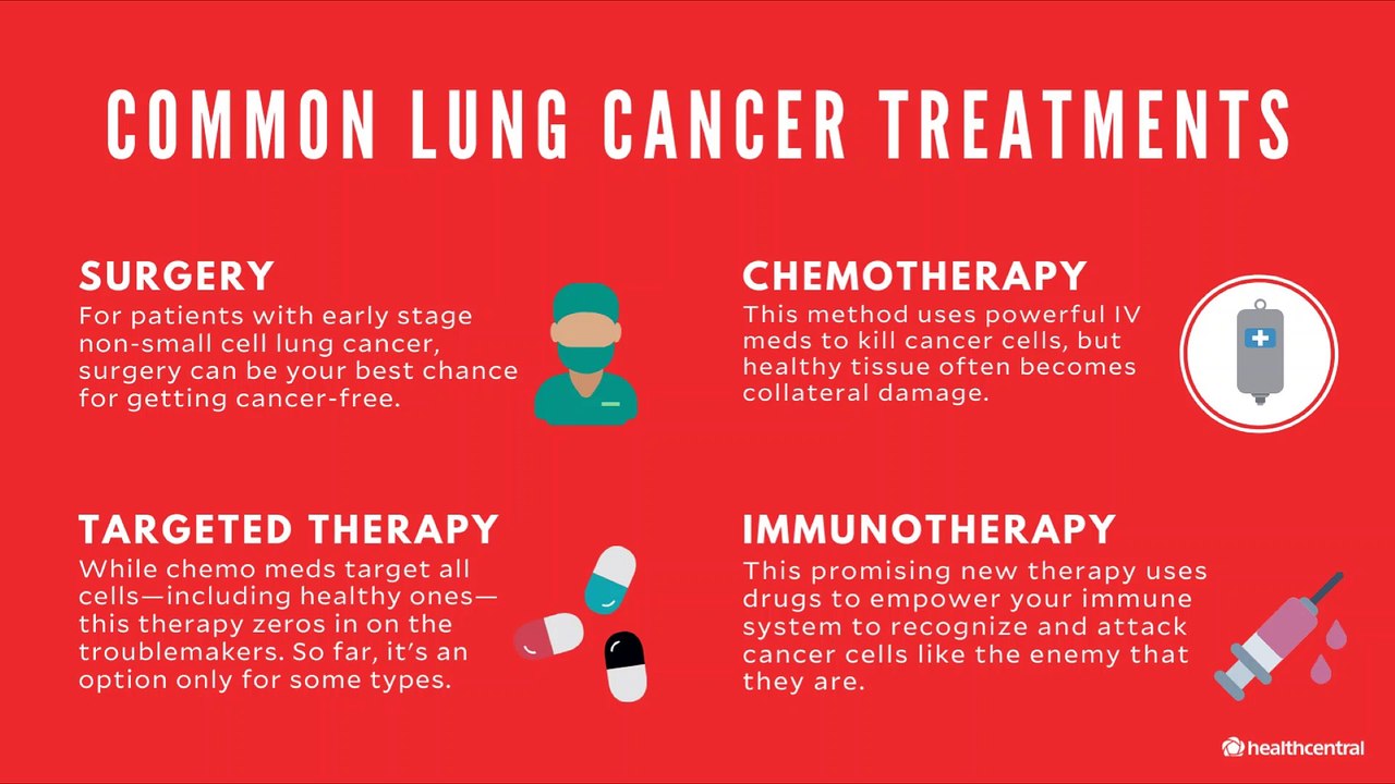 How to Treat Non-Small Cell Lung Cancer