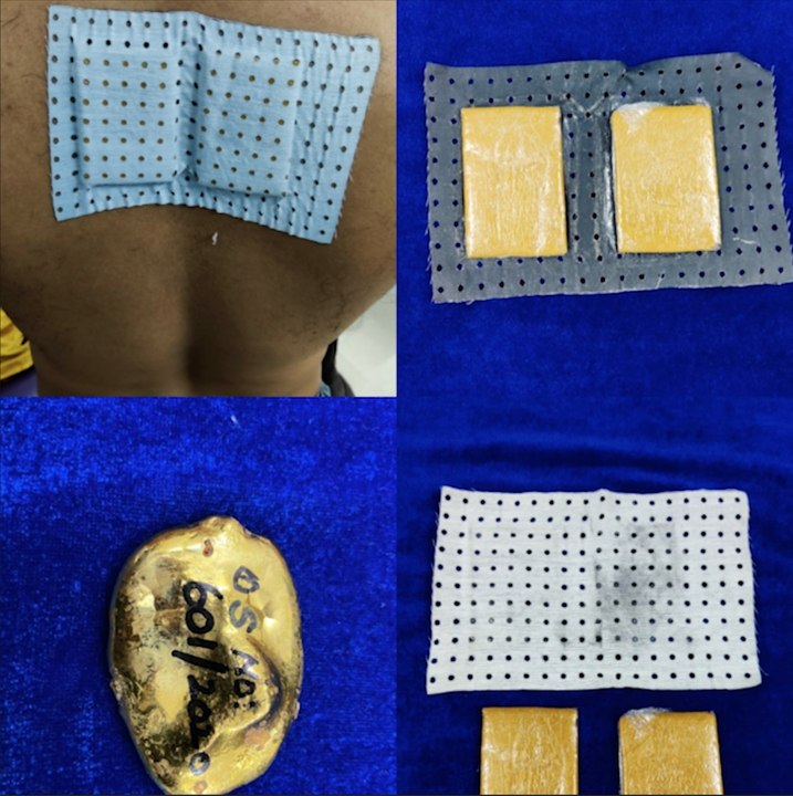 Chennai Customs seize gold worth Rs 7.5 lakh hidden under bandage