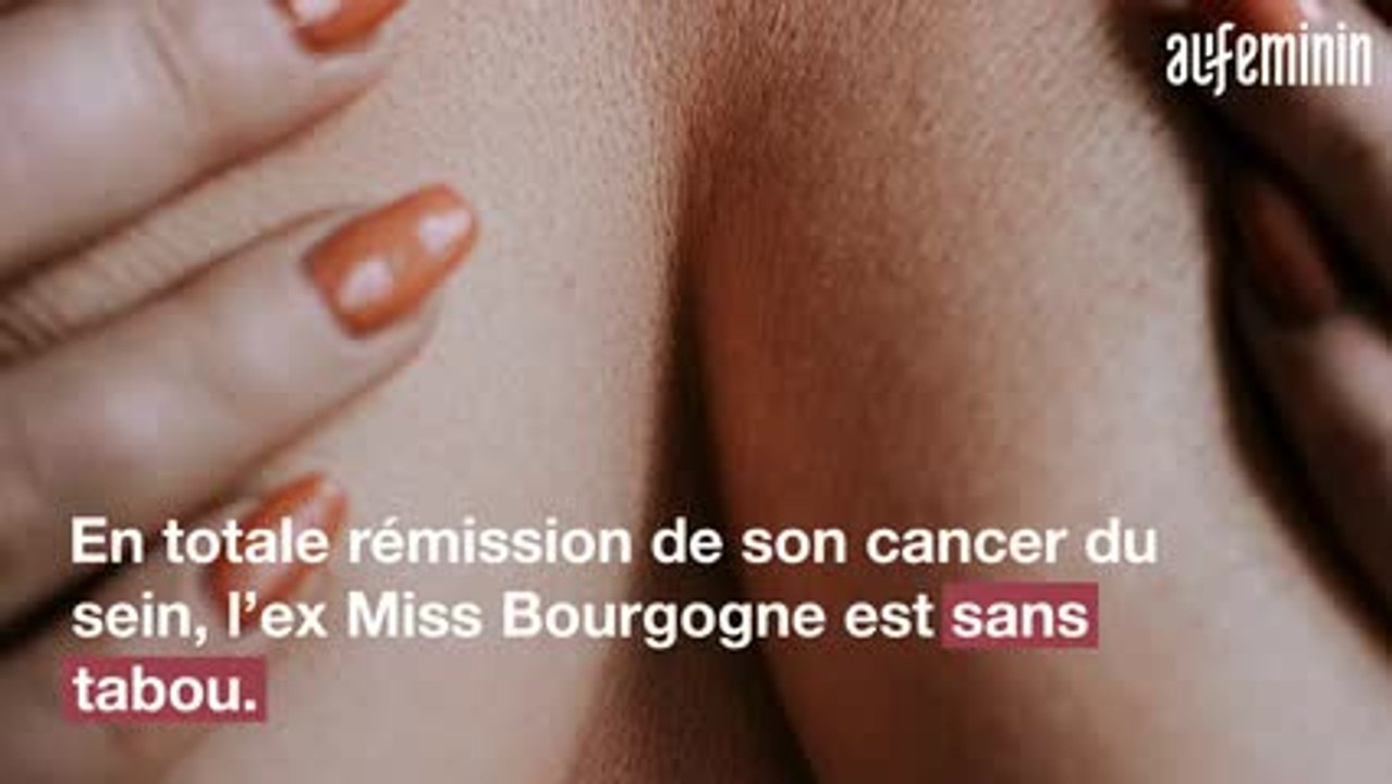 Alice Detollanaere dévoile sa poitrine "asymétrique"