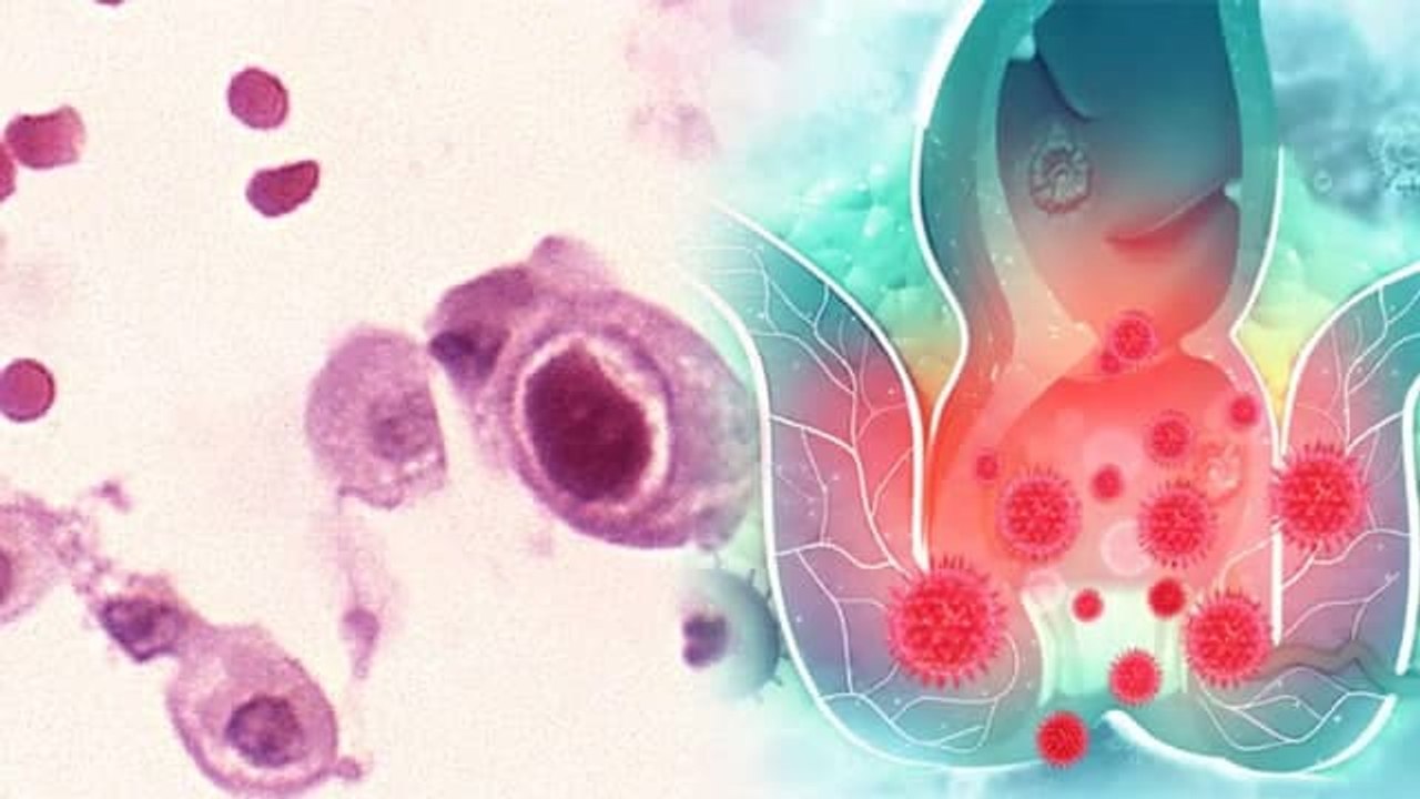 Post Corona Recovery के बाद Cytomegalovirus Infection का खतरा, Doctors Advice | Boldsky