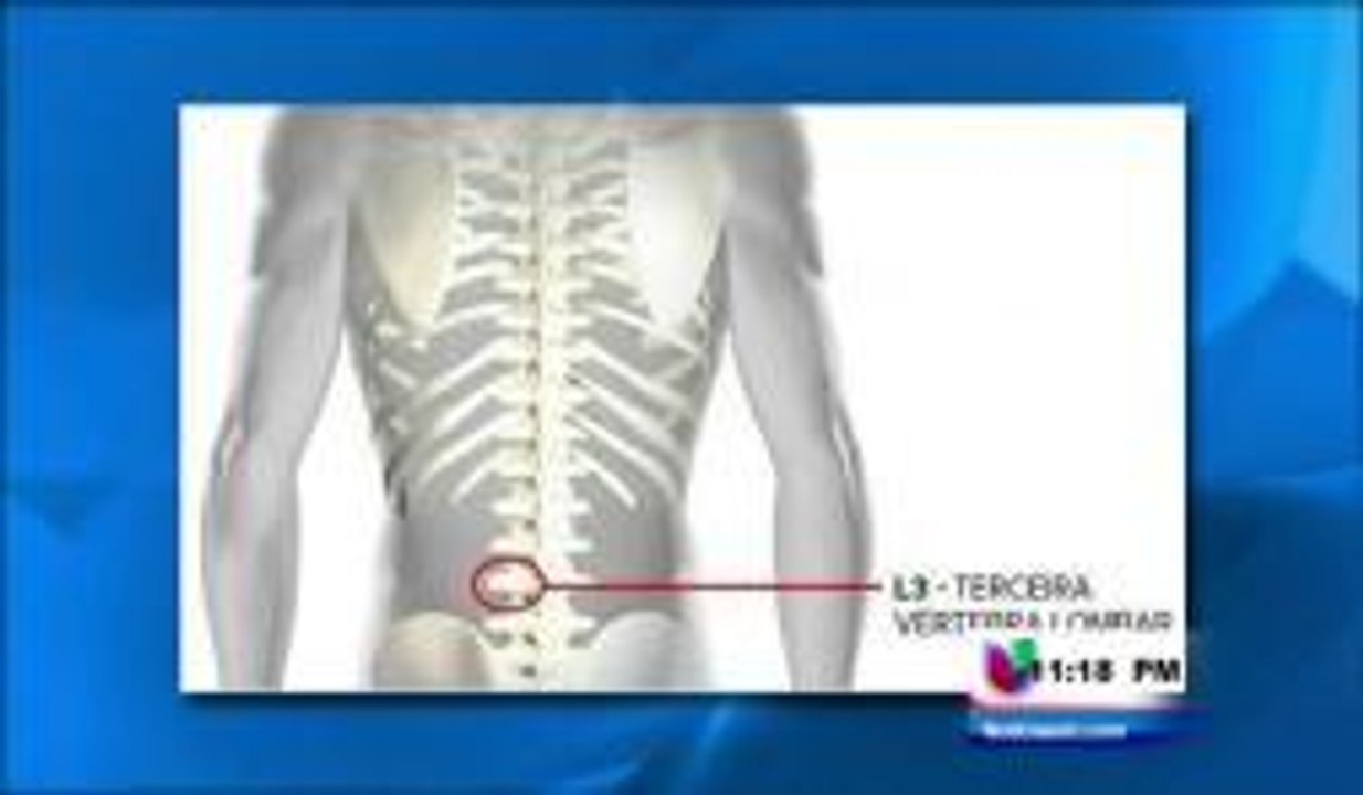 La lesión de Neymar explicada