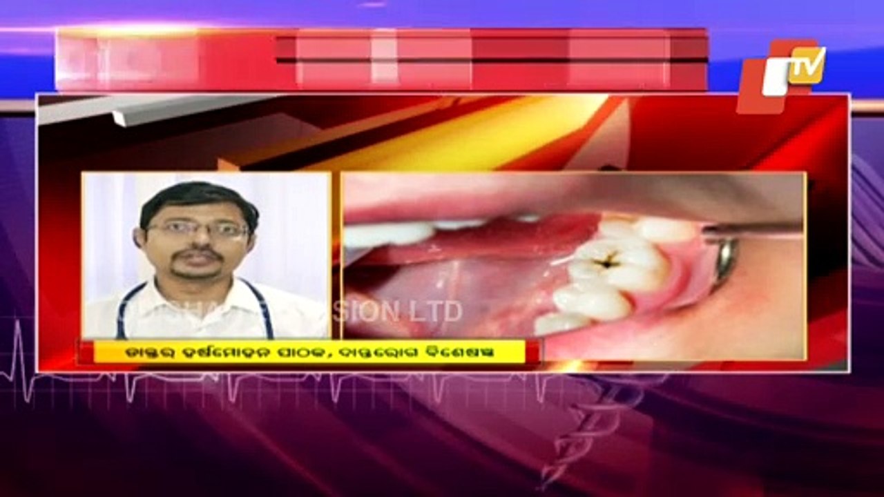 What Is Tooth Decay, Its Causes, Prevention And Treatment