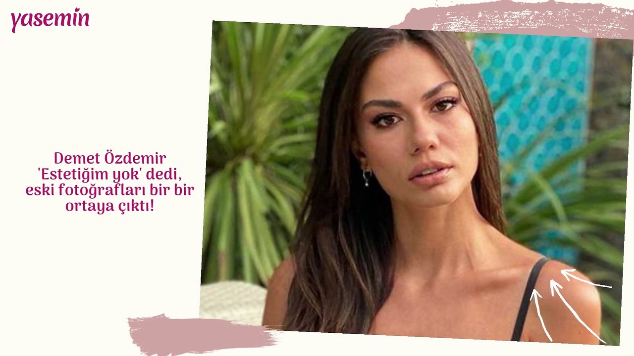 Demet Özdemir estetik iddialarına yanıt verdi!