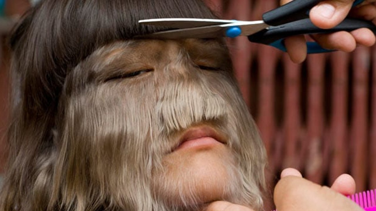 Current Appearance of the 'World's Hairiest Girl'