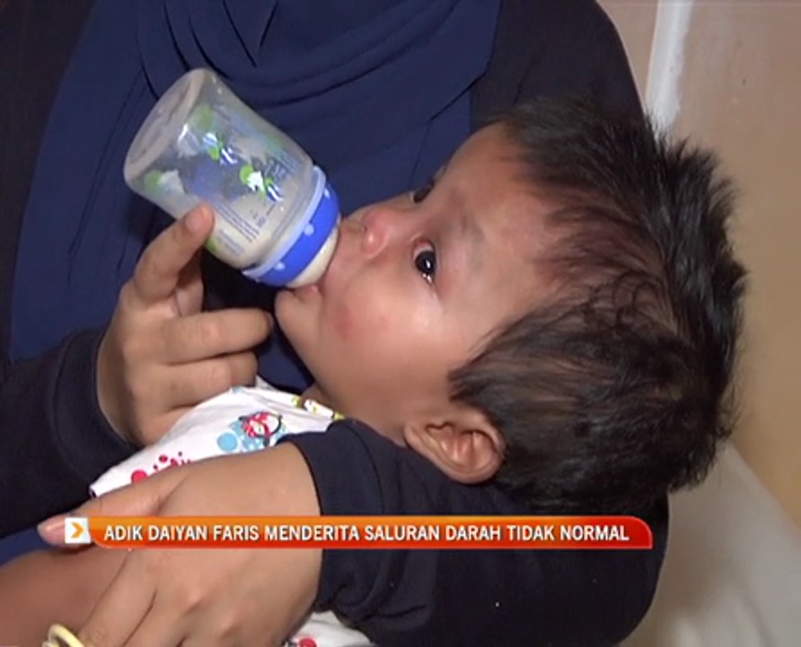 Adik Daiyan Faris menderita saluran darah tidak normal