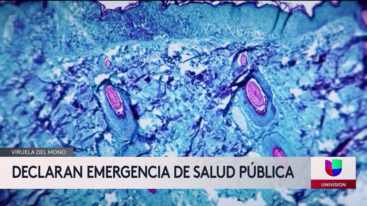 Declaran emergencia de salud pública