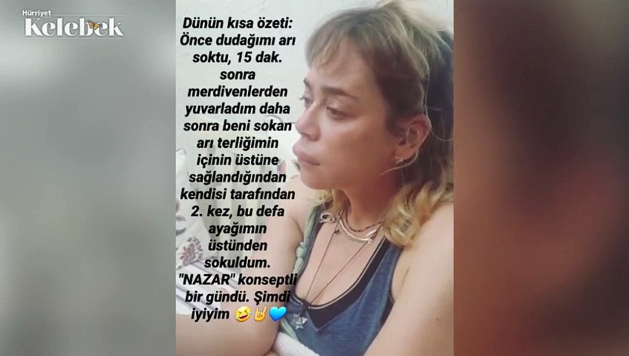 Demet Evgar dudağına arı soktu