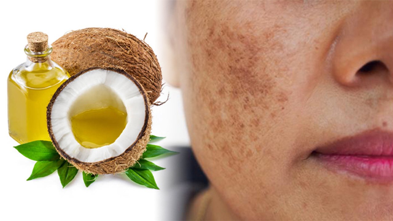 नारियल तेल लगाने से क्या चेहरा काला होता है ?।चेहरे पर नारियल का तेल लगाने से क्या होता है | Boldsky