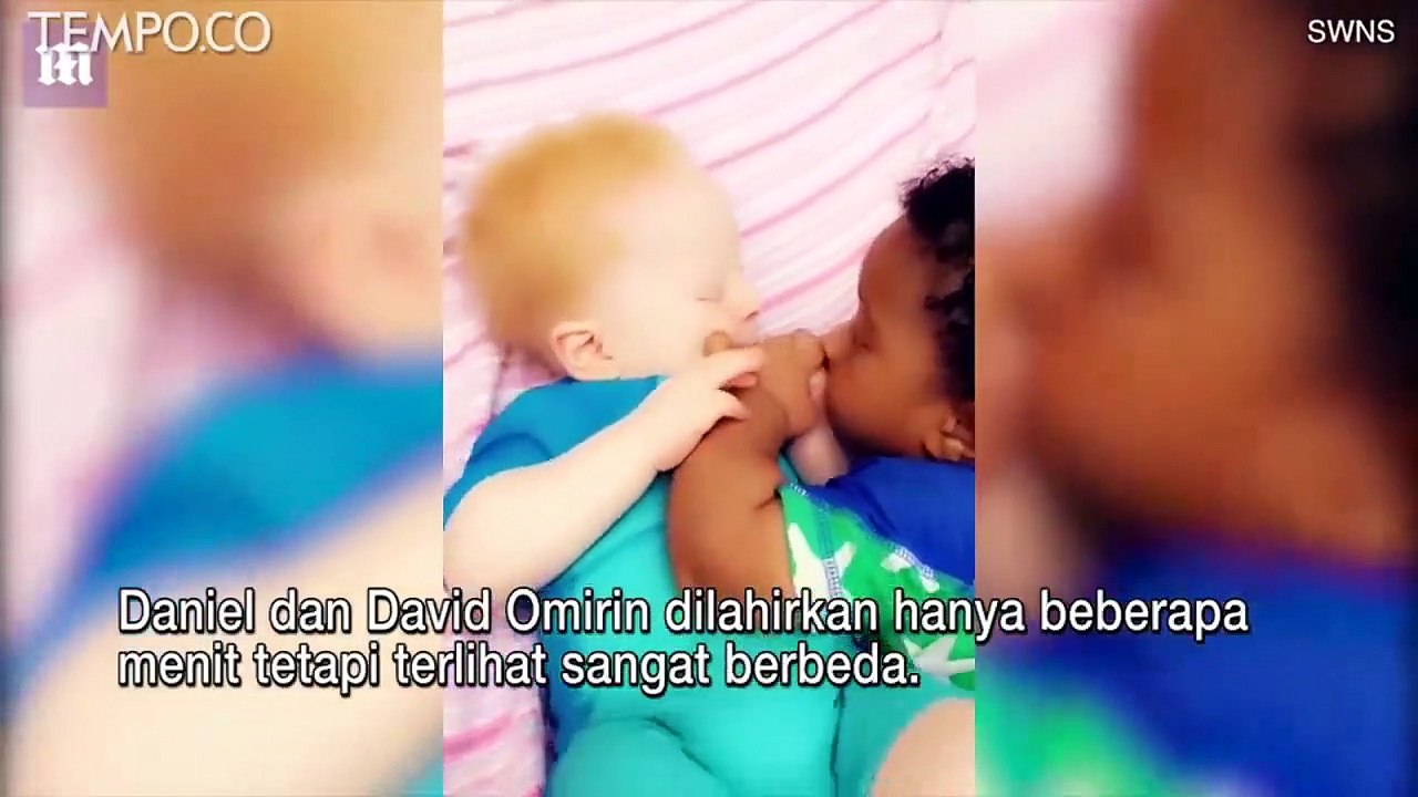 Ibu di Nigeria Punya Bayi Kembar Beda Warna, Satu Hitam, Satu Albino