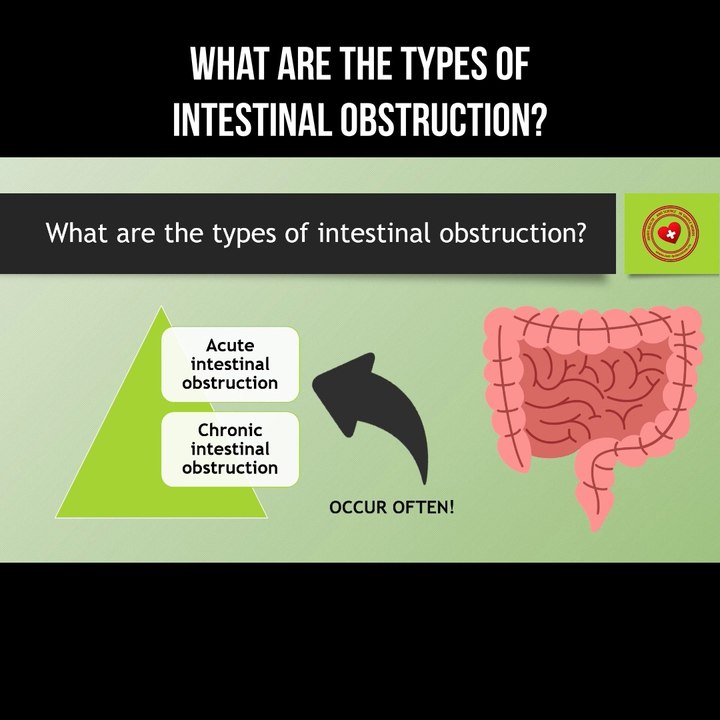 What are the types of intestinal obstruction?