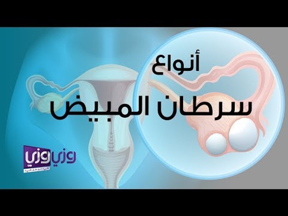أنواع سرطان المبيض