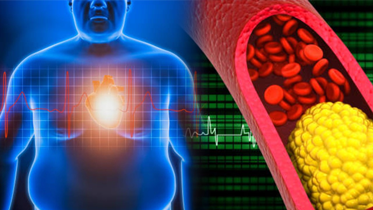 Obesity से Heart Attack का खतरा कैसे , मोटापे से हार्ट अटैक होता है क्या | Boldsky