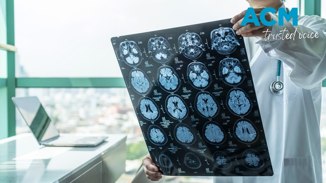 How to identify a stroke