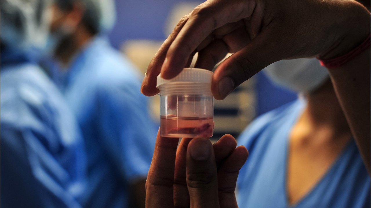 Fatal plant fungus infects man for first time and experts are on high alert, here's what you need to know