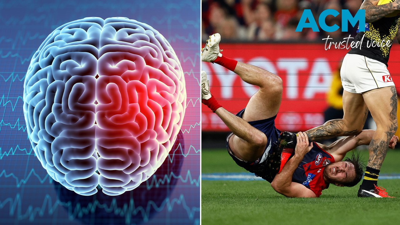 The truth about concussions in sport