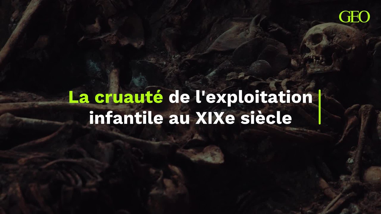 La cruauté de l'exploitation infantile au XIXe siècle révélée par des squelettes mutilés