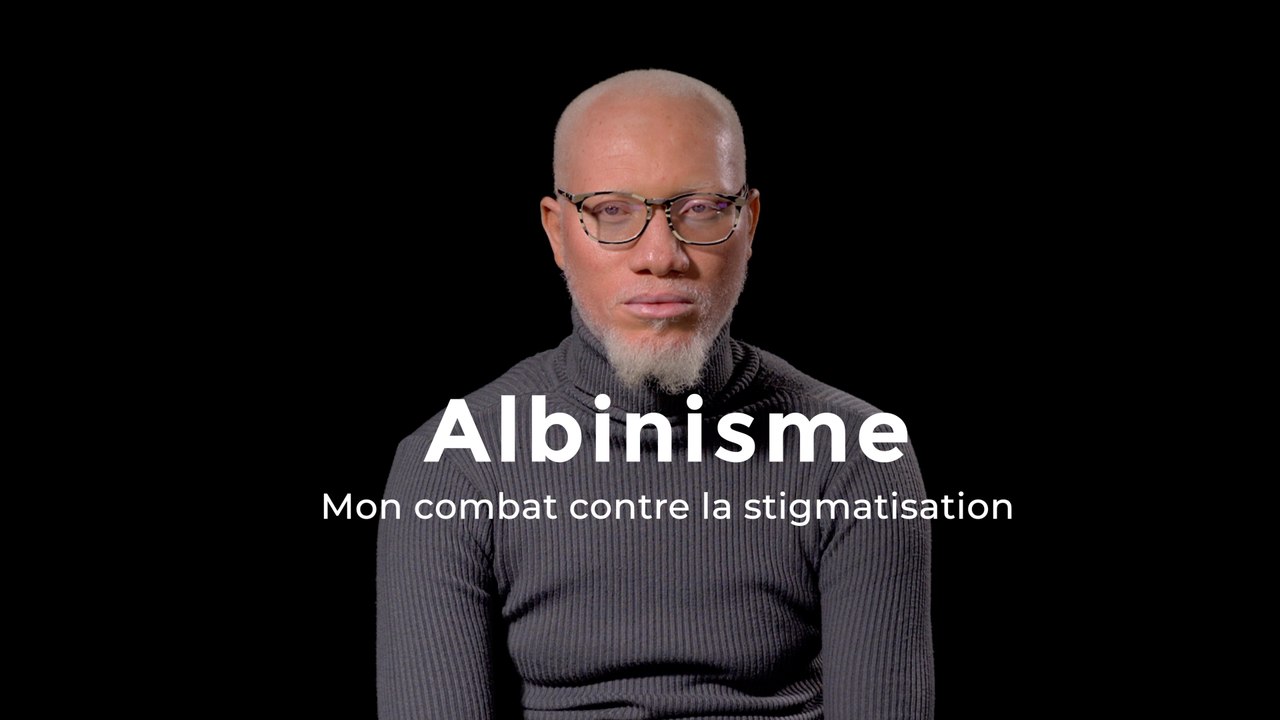 Mon combat contre la stigmatisation des albinos