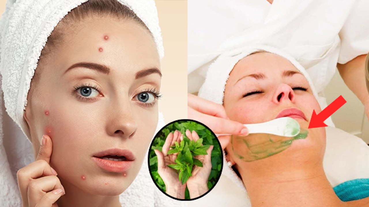 गर्मी में चेहरे के लाल दाने हटाने का तरीका | Garmi Me Chehre Ke Lal Dane Kaise Hataye | Boldsky