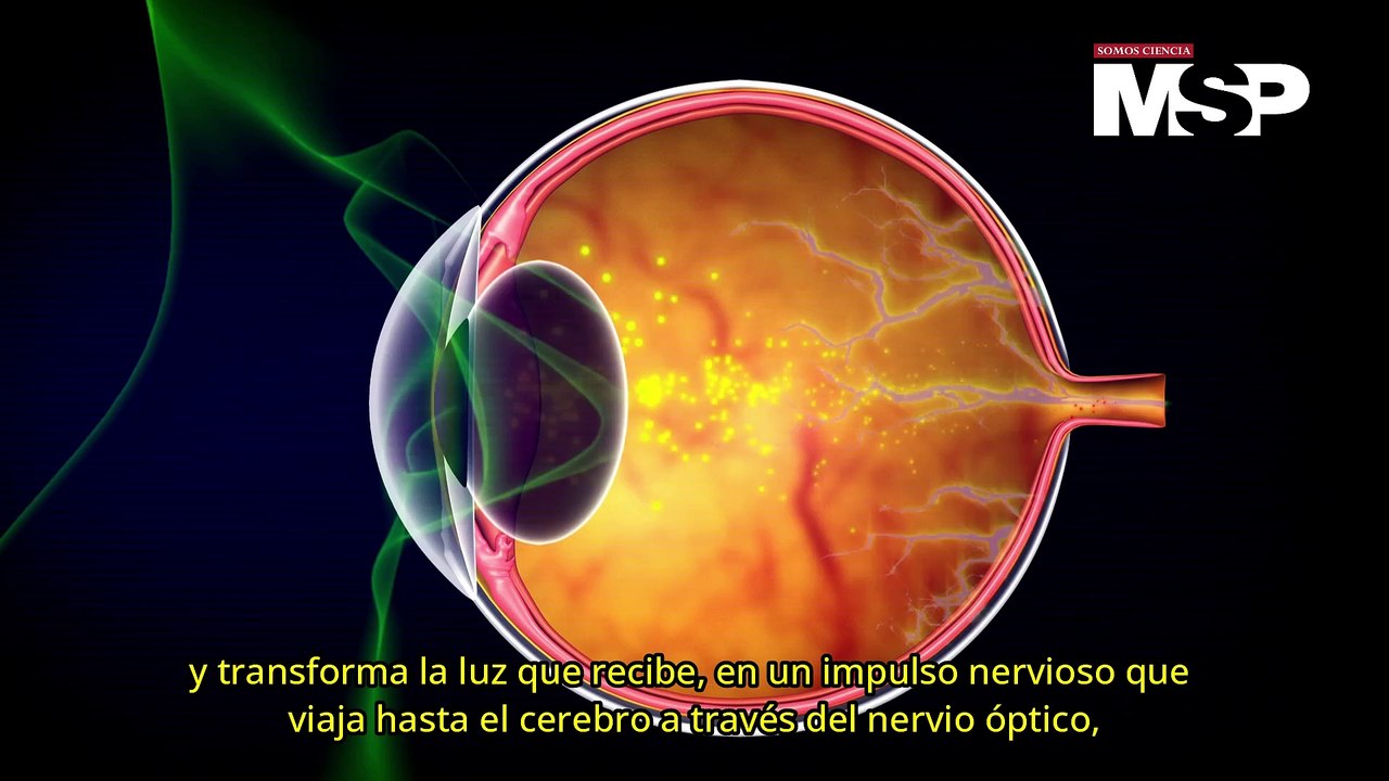 ¿Cómo funciona la miopía? - #ExclusivoMSP